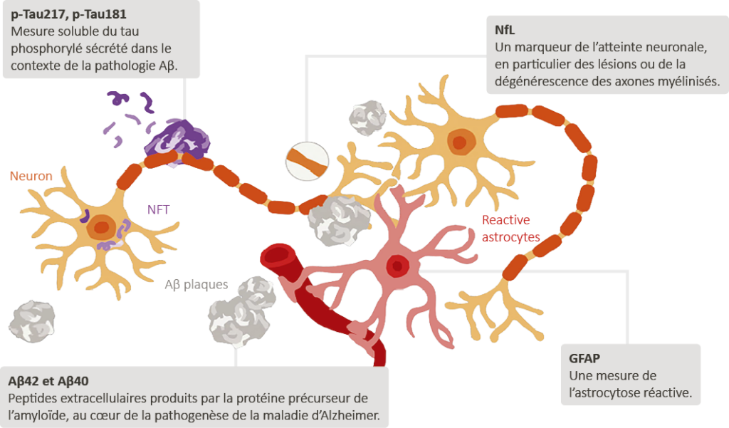 Ziekte Van Alzheimer Biomarkers In Bloed (plasma) Fr