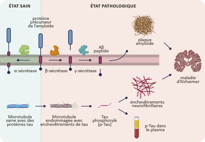 Ziekte Van Alzheimer Pathogenese 1 Fr