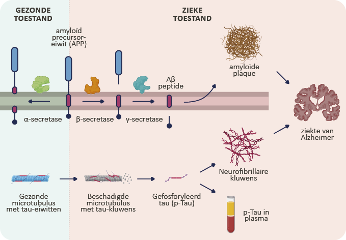 Ziekte Van Alzheimer Pathogenese 1